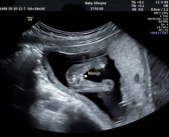 geslacht_meisje_website