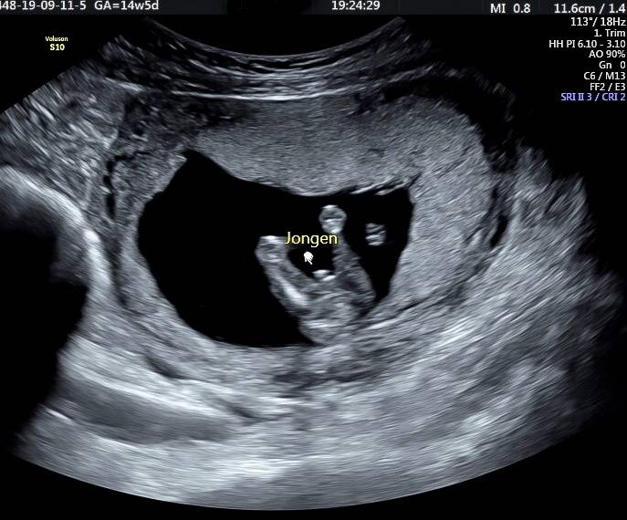 geslacht_website_jongen