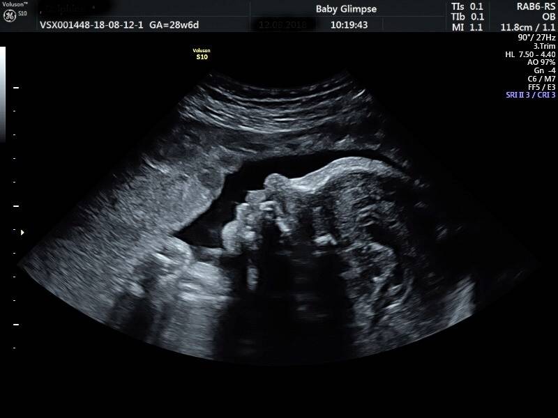 2d_echo_gezicht_website